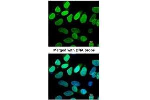 ICC/IF Image Immunofluorescence analysis of paraformaldehyde-fixed HeLa, using VCP(p97), antibody at 1:200 dilution. (VCP 抗体  (N-Term))