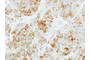 IHC-P Image Immunohistochemical analysis of paraffin-embedded MCF7 xenograft, using KYNU, antibody at 1:500 dilution. (KYNU 抗体)