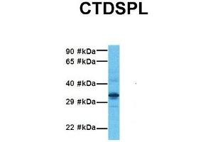 Host:  Rabbit  Target Name:  CTDSPL  Sample Tissue:  Human Fetal Liver  Antibody Dilution:  1. (CTDSPL 抗体  (N-Term))