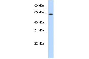 WB Suggested Anti-RNF6 Antibody Titration:  1. (RNF6 抗体  (N-Term))