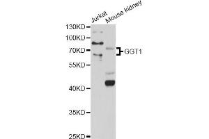 Western blot analysis of extracts of various cell lines, using GGT1 antibody (ABIN1872809) at 1:1000 dilution. (GGT1 抗体)