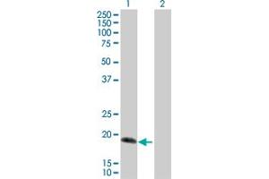 Western Blot analysis of IL17C expression in transfected 293T cell line by IL17C MaxPab polyclonal antibody. (IL17C 抗体  (AA 1-197))