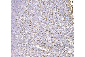 IHC analysis of SND1 using anti-SND1 antibody (ABIN7600525). (SND1 抗体  (AA 20-204))
