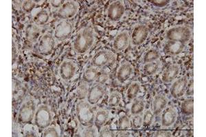 Image no. 1 for anti-SUMO1/sentrin Specific Protease 6 (SENP6) (AA 1-111) antibody (ABIN599203) (SENP6 抗体  (AA 1-111))