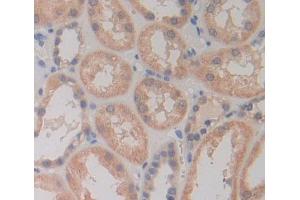 Used in DAB staining on fromalin fixed paraffin- embedded kidney tissue (PLCD4 抗体  (AA 1-250))