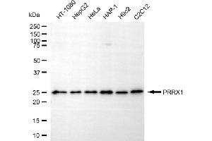 Western blotting analysis using PRRX1 antibody (ABIN7799728).