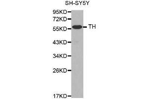 Western Blotting (WB) image for anti-Tyrosine Hydroxylase (TH) antibody (ABIN6213590) (Tyrosine Hydroxylase 抗体)