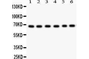 Anti- PKC iota Picoband antibody, Western blotting All lanes: Anti PKC iota  at 0.