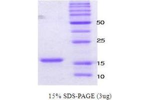 Figure annotation denotes ug of protein loaded and % gel used. (SNCA Protein (active))