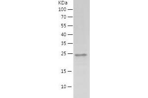 MED19 Protein (AA 1-194) (His tag)