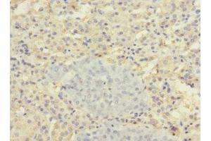 Immunohistochemistry (IHC) image for anti-Solute Carrier Family 22 (Organic Anion Transporter), Member 8 (SLC22A8) (AA 473-542) antibody (ABIN7170165)