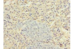 Immunohistochemistry of paraffin-embedded human adrenal gland tissue using ABIN7170165 at dilution of 1:100 (SLC22A8 抗体  (AA 473-542))