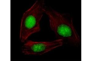 Immunofluorescence (IF) image for anti-Sterol Regulatory Element Binding Transcription Factor 2 (SREBF2) (AA 399-427) antibody (ABIN3032752)