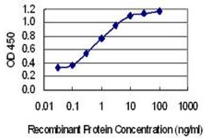 Detection limit for recombinant GST tagged FBXO41 is 0. (FBXO41 抗体  (AA 400-498))