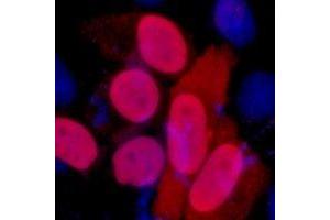 Immunofluorescent analysis of FLAG-tag staining in 293T cells transfected with a Flag-tag protein. (DYKDDDDK Tag 抗体)