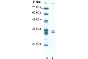 WB Suggested Anti-PKNOX2 Antibody Titration: 1. (PKNOX2 抗体  (N-Term))