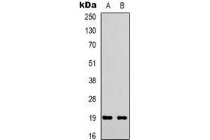 Western blot analysis of STMN1 (pS38) expression in Hela (A), Jurkat (B) whole cell lysates. (Stathmin 1 抗体  (N-Term, pSer38))