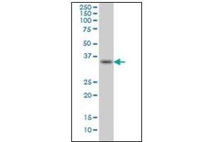 Western Blotting (WB) image for anti-Sprouty Homolog 1, Antagonist of FGF Signaling (SPRY1) antibody (ABIN781897)
