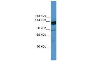 OGDHL antibody used at 0. (OGDHL 抗体  (N-Term))