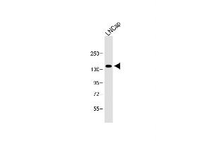 Anti-POTEE Antibody (Center) at 1:1000 dilution + LNCap whole cell lysate Lysates/proteins at 20 μg per lane. (POTEE 抗体  (AA 380-409))