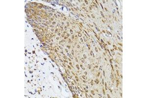 Immunohistochemistry of paraffin-embedded human esophagus using TOLLIP antibody. (TOLLIP 抗体)