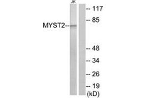 Western Blotting (WB) image for anti-MYST Histone Acetyltransferase 2 (MYST2) (AA 131-180) antibody (ABIN2889358) (MYST2 抗体  (AA 131-180))
