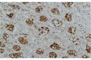 Immunohistochemistry of paraffin-embedded Human kidney tissue using NFKBIB Monoclonal Antibody at dilution of 1:200. (NFKBIB 抗体)