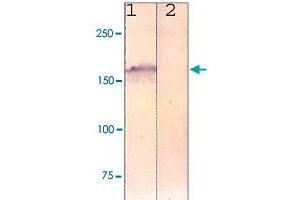 The cell lysate derived from NIH/3T3 was immunoprobed by LRP6 polyclonal antibody  at 1 : 500. (LRP6 抗体)