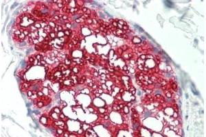 anti-Hydroxy-delta-5-Steroid Dehydrogenase, 3 beta- and Steroid delta-Isomerase 1 (HSD3B1) (AA 1-374) antibody