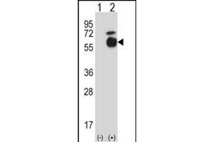 Western blot analysis of Acvr1 (arrow) using rabbit polyclonal Mouse Acvr1 Antibody (Center) (ABIN657718 and ABIN2846706). (ACVR1 抗体  (AA 137-166))