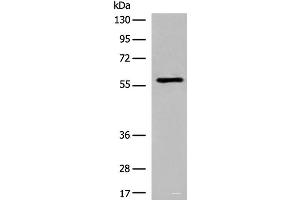 Western blot analysis of Jurkat cell lysate using M1AP Polyclonal Antibody at dilution of 1:600 (Meiosis 1 Associated Protein (M1AP) 抗体)