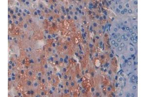IHC-P analysis of Rat Adrenal gland Tissue, with DAB staining. (ADAMTS1 抗体  (AA 854-967))