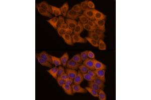 Immunofluorescence analysis of HeLa cells using GSDMD Rabbit pAb  at dilution of 1:200 (40x lens). (GSDMD 抗体)
