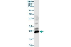 Immunoprecipitation of GUCA1C transfected lysate using anti-GUCA1C MaxPab rabbit polyclonal antibody and Protein A Magnetic Bead , and immunoblotted with GUCA1C purified MaxPab mouse polyclonal antibody (B01P) . (GUCA1C 抗体  (AA 1-209))