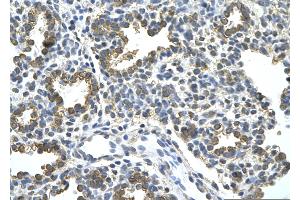 Rabbit Anti-HDAC9 Antibody       Paraffin Embedded Tissue:  Human alveolar cell   Cellular Data:  Epithelial cells of renal tubule  Antibody Concentration:   4. (HDAC9 抗体  (C-Term))