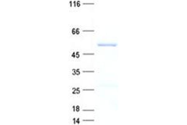 NSUN7 Protein (His tag)