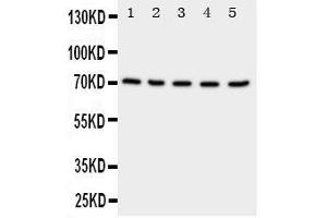 Anti-NRG1 antibody, Western blotting Lane 1: Rat Spleen Tissue Lysate Lane 2: Rat Kidney Tissue Lysate Lane 3: Rat Brain Tissue Lysate Lane 4: HELA Cell Lysate Lane 5: SMMC Cell Lysate (Neuregulin 1 抗体  (C-Term))