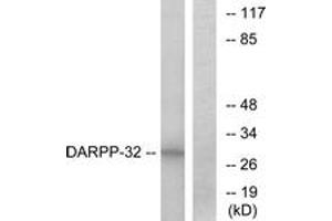 Western blot analysis of extracts from COS7 cells, treated with forskolin 40nM 30', using DARPP-32 (Ab-34) Antibody. (DARPP32 抗体  (AA 18-67))