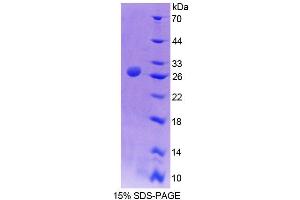 SDS-PAGE (SDS) image for Alanine Glyoxylate Aminotransferase (AGXT) (AA 120-334) protein (His tag) (ABIN6239078) (AGXT Protein (AA 120-334) (His tag))