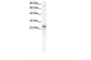 Image no. 1 for anti-NK2 Homeobox 8 (NKX2-8) (C-Term) antibody (ABIN6735828) (NKX2-8 抗体  (C-Term))