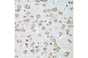 Immunohistochemistry of paraffin-embedded mouse brain using EIF1AX antibody at dilution of 1:100 (40x lens). (EIF1AX 抗体)