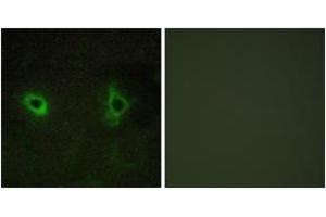 Immunofluorescence analysis of COS7 cells, using Collagen IV alpha3 Antibody. (COL4a3 抗体  (AA 801-850))