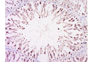 Paraformaldehyde-fixed, paraffin embedded rat testis, Antigen retrieval by boiling in sodium citrate buffer (pH6) for 15min, Block endogenous peroxidase by 3% hydrogen peroxide for 30 minutes, Blocking buffer (normal goat serum) at 37°C for 20min, Antibody incubation with Rabbit Anti-CCDC98 Polyclonal Antibody, Unconjugated  at 1:500 overnight at 4°C, followed by a conjugated secondary for 90 minutes and DAB staining. (CCDC98 抗体  (AA 51-150))