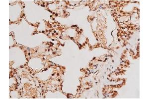 Immunohistochemistry (IHC) image for anti-Signal Transducer and Activator of Transcription 3 (Acute-Phase Response Factor) (STAT3) (pTyr705) antibody (ABIN6255995)