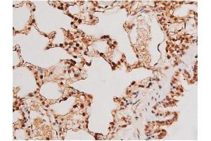 ABIN6267502 at 1/200 staining Rat lung tissue sections by IHC-P. (STAT3 抗体  (pTyr705))