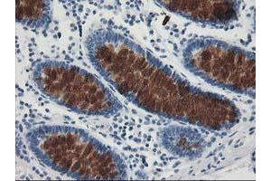 Immunohistochemical staining of paraffin-embedded Human colon tissue using anti-AP2M1 mouse monoclonal antibody. (AP2M1 抗体  (AA 97-383))