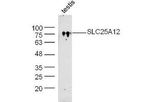 Mouse testis lysate probed with Rabbit Anti-SLC25A12/ARALAR Polyclonal Antibody, Unconjugated  at 1:300 overnight at 4˚C. (SLC25A12 抗体  (AA 101-200))