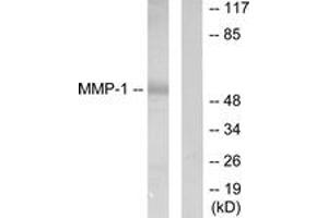 Western blot analysis of extracts from HepG2 cells, using MMP-1 Antibody.