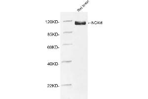 Western blot analysis of tissue lysates using 1 µg/mL Rabbit Anti-NCAM Polyclonal Antibody (ABIN398893) The signal was developed with IRDyeTM 800 Conjugated Goat Anti-Rabbit IgG. (CD56 抗体  (AA 780-830))
