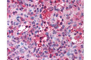 Immunohistochemistry (IHC) image for anti-Solute Carrier Family 4, Anion Exchanger, Member 1 (erythrocyte Membrane Protein Band 3, Diego Blood Group) (SLC4A1) (AA 184-233) antibody (ABIN6736430)